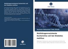Bookcover of Multidrogenresistente Escherichia coli bei Diabetes mellitus