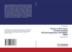 Buchcover von Tissue is the issue: Endobronchial Ultrasonography and EBUS-TBNA
