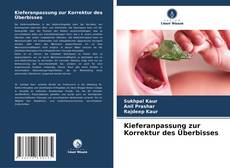 Bookcover of Kieferanpassung zur Korrektur des Überbisses