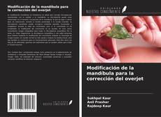 Buchcover von Modificación de la mandíbula para la corrección del overjet