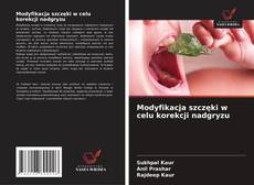 Capa do livro de Modyfikacja szczęki w celu korekcji nadgryzu 