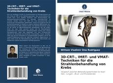 Bookcover of 3D-CRT-, IMRT- und VMAT-Techniken für die Strahlenbehandlung von Krebs