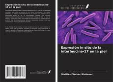 Buchcover von Expresión in situ de la interleucina-17 en la piel