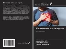 Capa do livro de Síndrome coronario agudo 