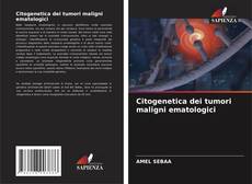 Buchcover von Citogenetica dei tumori maligni ematologici