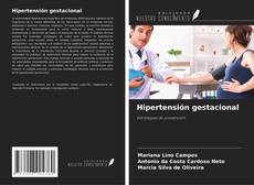 Copertina di Hipertensión gestacional