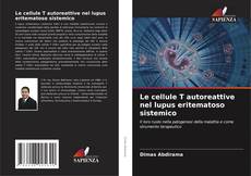 Bookcover of Le cellule T autoreattive nel lupus eritematoso sistemico