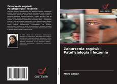 Couverture de Zaburzenia rogówki Patofizjologia i leczenie