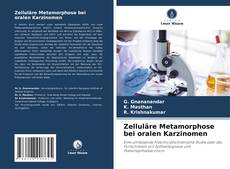 Portada del libro de Zelluläre Metamorphose bei oralen Karzinomen