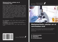 Capa do livro de Metamorfosis celular en el carcinoma oral 