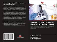 Buchcover von Métamorphose cellulaire dans le carcinome buccal