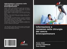 Couverture de Informazione e consenso nella chirurgia del cancro broncopolmonare