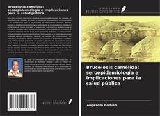 Couverture de Brucelosis camélida: seroepidemiología e implicaciones para la salud pública