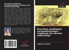 Copertina di Bruceloza wielbłądów: seroepidemiologia i implikacje dla zdrowia publicznego