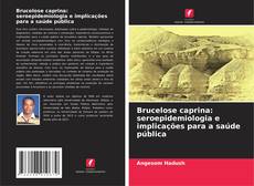 Couverture de Brucelose caprina: seroepidemiologia e implicações para a saúde pública
