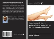 Buchcover von Aspectos quirúrgicos y psicológicos de las varices en las extremidades inferiores
