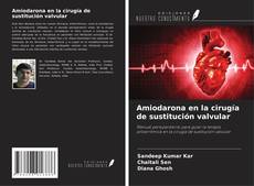Обложка Amiodarona en la cirugía de sustitución valvular