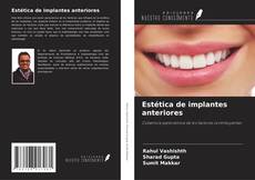 Capa do livro de Estética de implantes anteriores 
