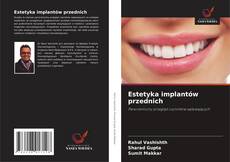Bookcover of Estetyka implantów przednich