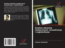 Copertina di Analiza obrazów medycznych, wizualizacja i segmentacja