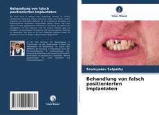 Copertina di Behandlung von falsch positionierten Implantaten
