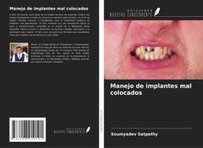 Buchcover von Manejo de implantes mal colocados