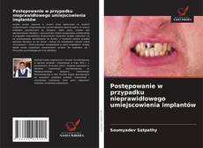 Borítókép a  Postępowanie w przypadku nieprawidłowego umiejscowienia implantów - hoz