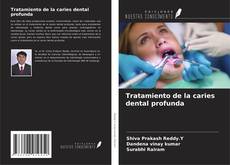 Capa do livro de Tratamiento de la caries dental profunda 