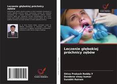 Leczenie głębokiej próchnicy zębów的封面
