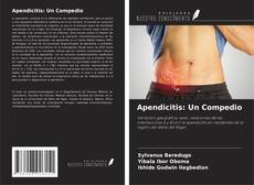 Buchcover von Apendicitis: Un Compedio
