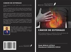 Couverture de CÁNCER DE ESTÓMAGO