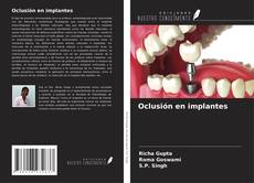 Portada del libro de Oclusión en implantes