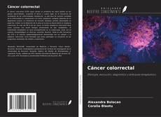 Copertina di Cáncer colorrectal