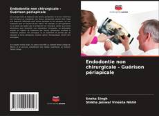 Buchcover von Endodontie non chirurgicale - Guérison périapicale