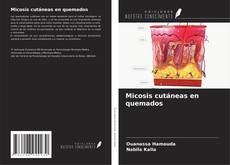 Borítókép a  Micosis cutáneas en quemados - hoz
