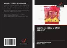 Couverture de Grzybice skóry u ofiar oparzeń