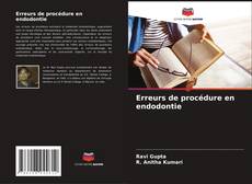 Buchcover von Erreurs de procédure en endodontie