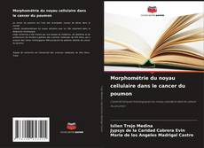 Buchcover von Morphométrie du noyau cellulaire dans le cancer du poumon