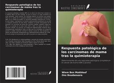 Couverture de Respuesta patológica de los carcinomas de mama tras la quimioterapia