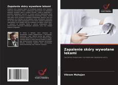 Bookcover of Zapalenie skóry wywołane lekami