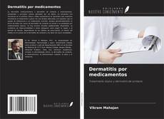 Capa do livro de Dermatitis por medicamentos 