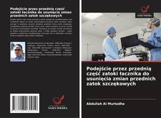 Podejście przez przednią część zatoki łacznika do usunięcia zmian przednich zatok szczękowych的封面