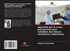 Copertina di Approche par le creux pré-lacrimal pour l'ablation des lésions maxillaires antérieures