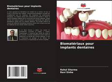 Portada del libro de Biomatériaux pour implants dentaires