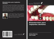 Copertina di Biomateriales para implantes dentales