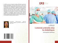 L'atteinte artérielle chez les diabétiques的封面
