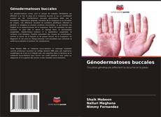 Buchcover von Génodermatoses buccales