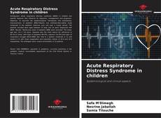 Buchcover von Acute Respiratory Distress Syndrome in children