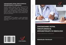 Buchcover von ZARZĄDZANIE OSTRĄ TOKSYCZNOŚCIĄ IMMUNOTERAPII W ONKOLOGII