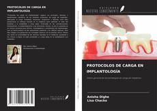 Portada del libro de PROTOCOLOS DE CARGA EN IMPLANTOLOGÍA